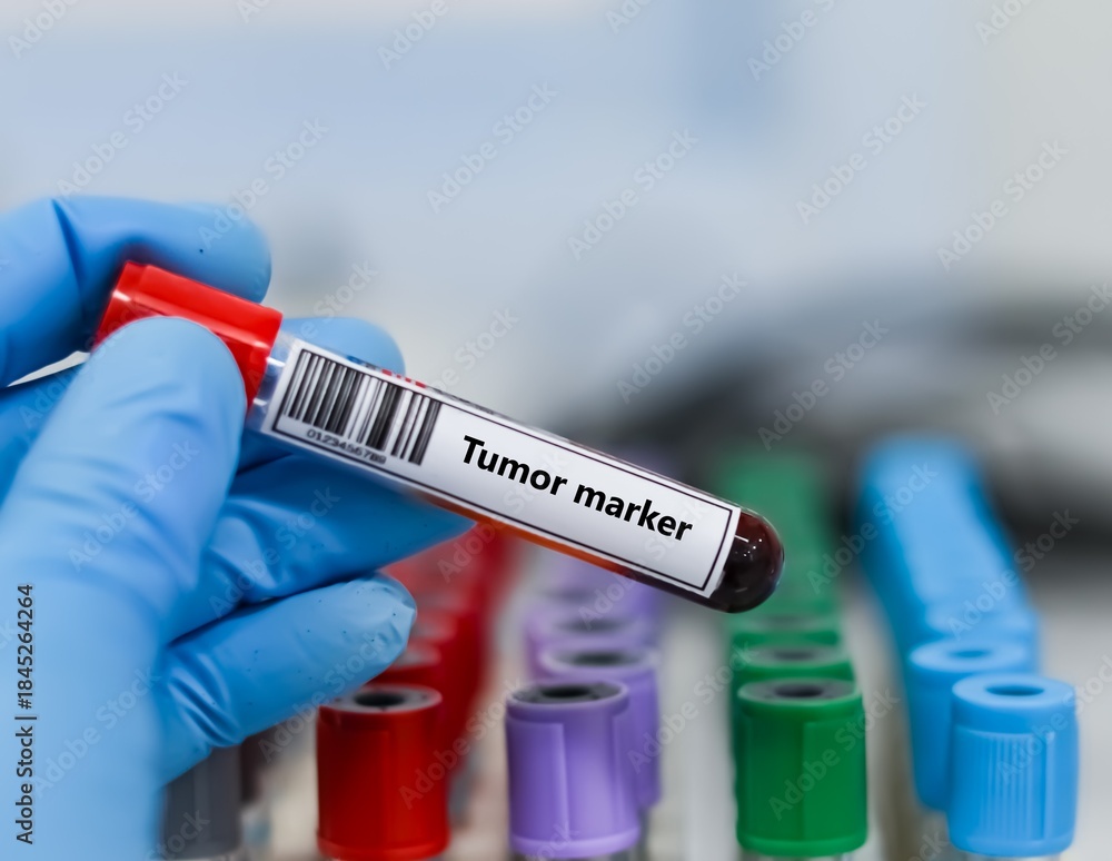 Oncology Biomarkers image 1